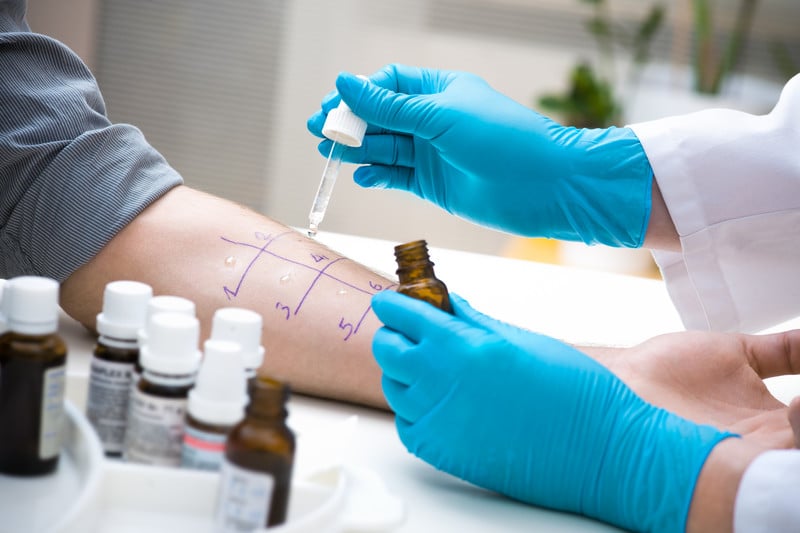 Allergy specialist in Delhi