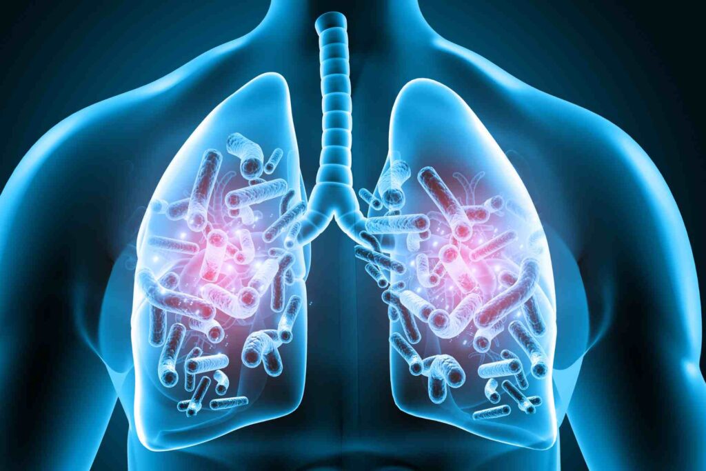 COPD Treatment in Delhi